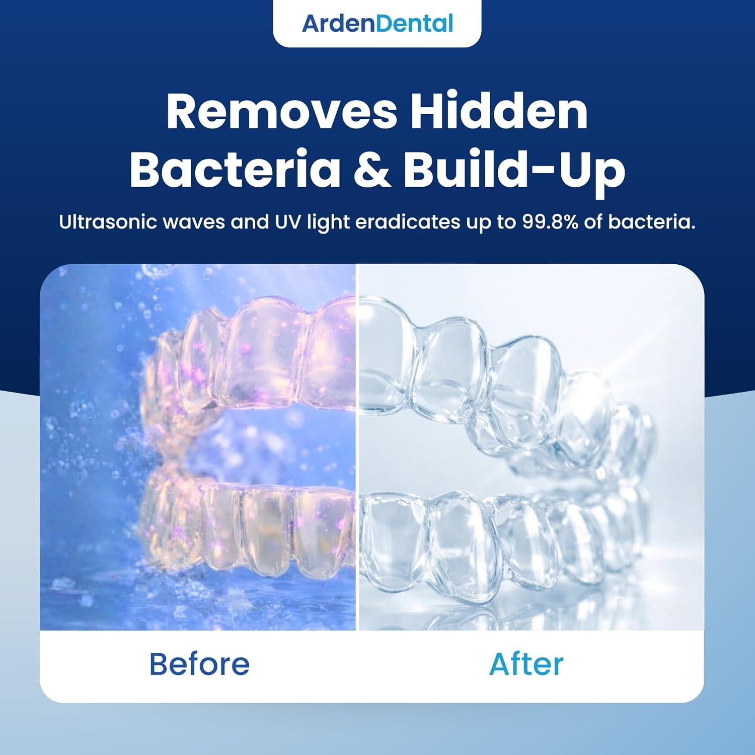 ArdenDental Ultrasonic Retainer Cleaner with UV-C Light — image 6